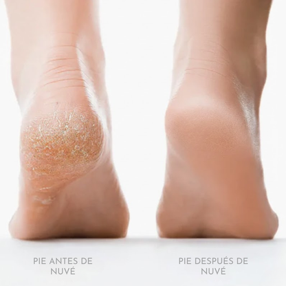 Nuvé Silk 3 Pro - El cuidado diario que tus pies necesitaban.